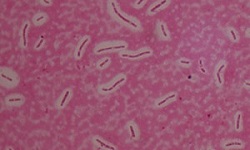 Capsule Staining